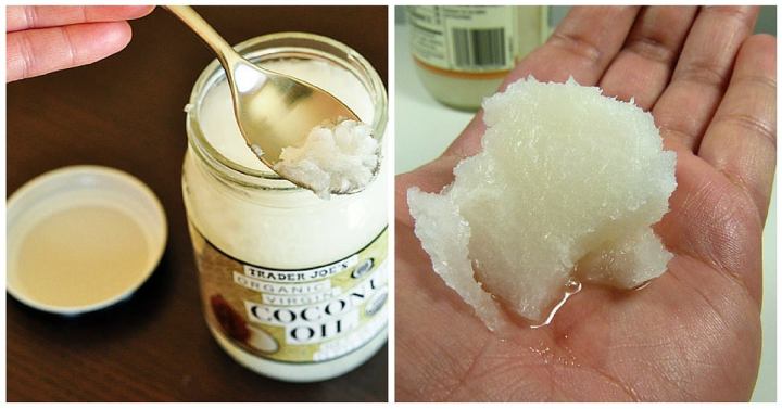 Olio di cocco e bicarbonato – per una pelle&nbsp;sana