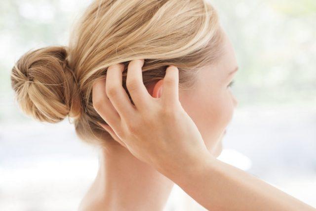 prurito-in-testa-rimedi-640x427